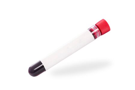 Single blood sample test tube with  blank sticker isolated on a white backgroundの写真素材