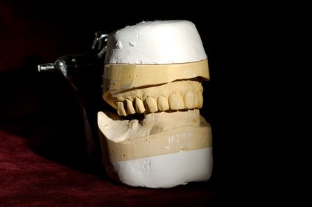 Photo of a Dental Mold