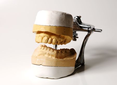 Photo of a Dental Moldの写真素材