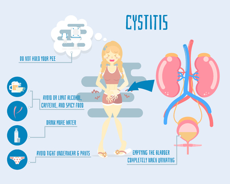 woman holding pee with kidney and bladder anatomy, health care infographic, cystitis concept, flat character design clip art vector illustration cartoonのイラスト素材