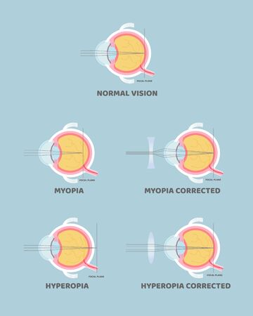Vector of eyeball anatomy, internal - ID:1-143489463 - Royalty Free ...