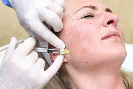 Anti-age injection therapy. Mimic wrinkles reduction