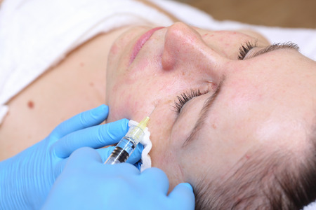 Anti-age injection therapy. Mimic wrinkles reductionの写真素材