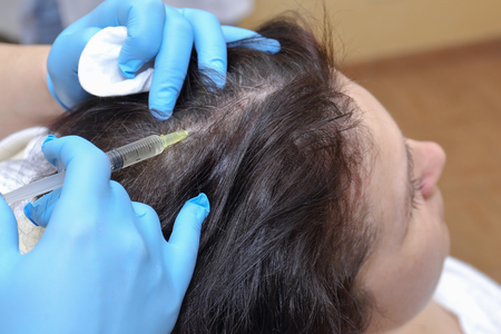 Anti hair loss injection in clinicの写真素材