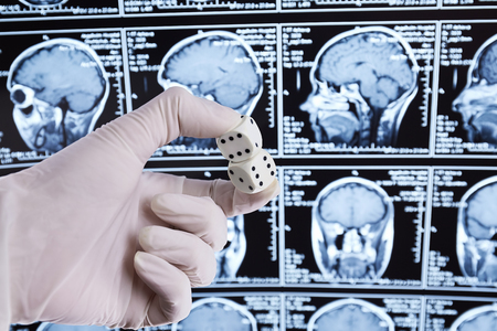 Magnetic resonance scan of the brain. MRI. Dice in hand.の写真素材