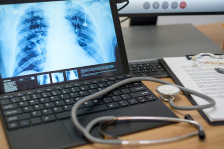 work table of doctor before online video conference with patient at hospitalの写真素材