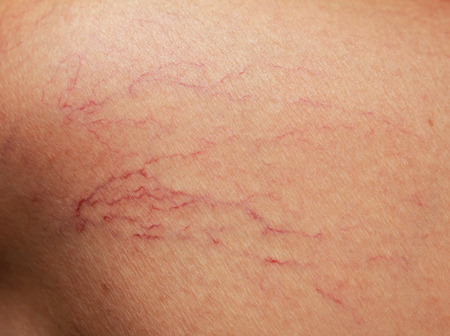 veins on the skin. closeの写真素材