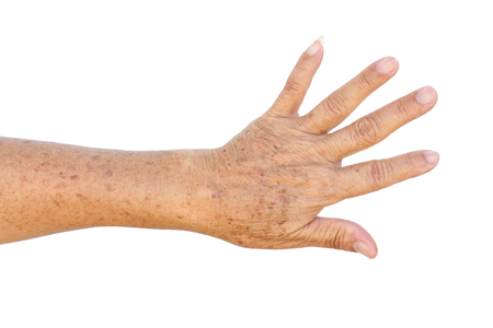Old Asian female hands full of freckles and wrinkles / Aging conceptの写真素材