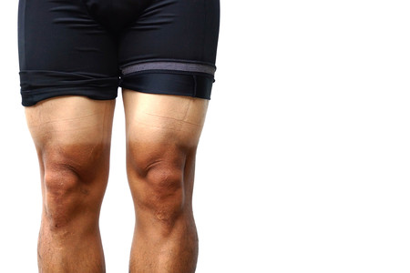Sunburn. Mountain bike cyclist with massive sunburn on his legs isolated on white with copy space to...