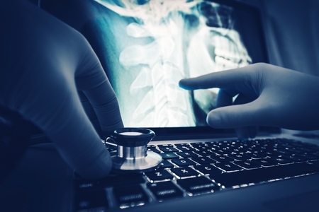 Doctor Xray Imagery Examination on the Laptop Computer.の写真素材