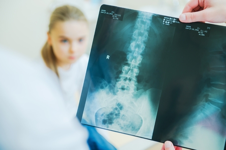 Children Xray Scanning Concept Photo with X Ray Imagery and Little Girl Patient in Background.