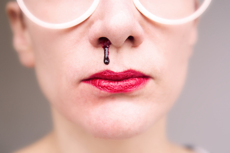 closeup of woman wearing glasses and having nosebleedの写真素材