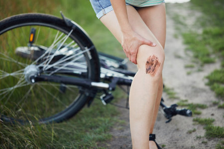 Young woman holds on to her injured knee after falling from a bicycleの写真素材