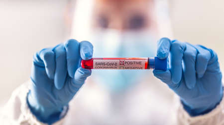 Detail of a positive Covid-19 test held by healthcare staff worker in protective gloves.