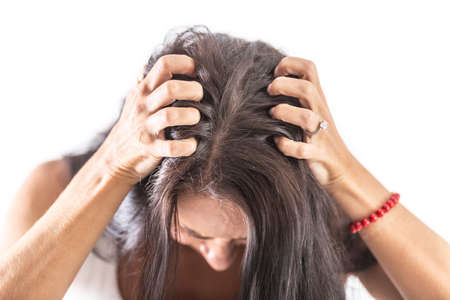 Brunette woman on isolated background scratching her head because of strong head itching.の写真素材
