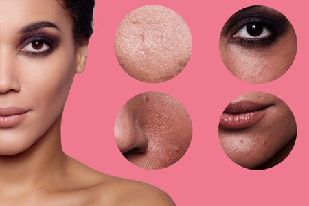 concept skincare. Skin of beauty young woman before and after the procedure on background, girl, mulatto girl. studio shotの写真素材