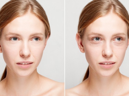 Before and after cosmetic operation. Young pretty woman portrait, isolated on a white background. Before and after cosmetic or plastic procedure, anti-age therapyの写真素材