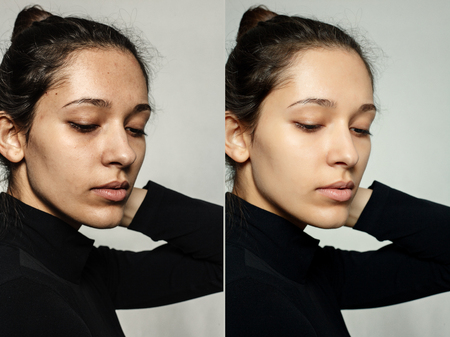 health, people, youth and beauty concept - Before and after cosmetic operation. Young pretty woman...