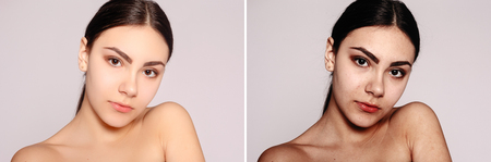 health, people, youth and beauty concept - Before and after cosmetic operation. Young pretty woman portrait. Before and after cosmetic or plastic procedure anti-age therapy, treatmentの写真素材