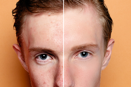 Before and after cosmetic operation. Young man portrait, studio background. Before and after cosmetic or plastic procedure, anti-age therapy, removal of acne, retouching. studio shotの写真素材