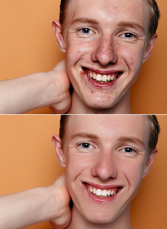 Before and after cosmetic operation. Young man portrait, studio background. Before and after cosmetic or plastic procedure, anti-age therapy, removal of acne, retouching. studio shotの写真素材