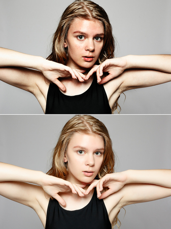 Before and after cosmetic operation. Young pretty woman portrait, isolated on a white background....