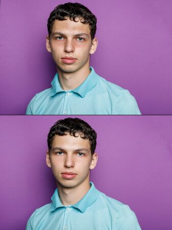 Before and after cosmetic operation. Young man portrait. Before and after cosmetic or plastic procedure, anti-age therapy, removal of acne, retouching. studio shotの写真素材
