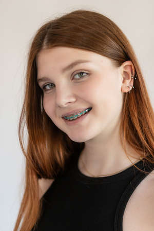 Portrait of an emotional red-haired girl with freckles and braces on a white background.の写真素材