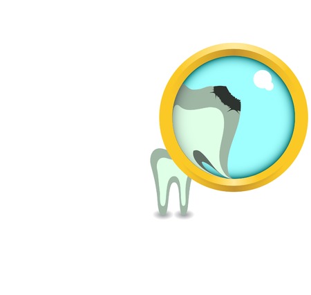 Sick tooth in increase. Vector. Without mesh.のイラスト素材