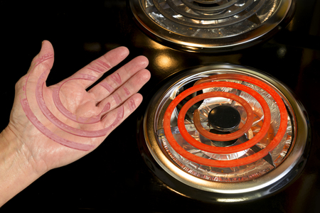 Horizontal shot of a Scarred Hand Burned on Stove Top.の写真素材