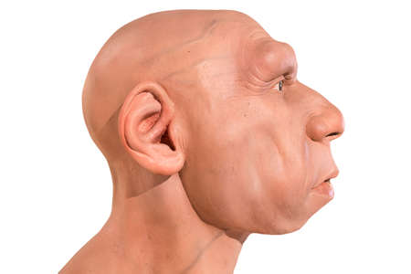 Montilla, Spain - March 2nd, 2019: Life-sized Neanderthal bust at Montilla Local History Museum,...
