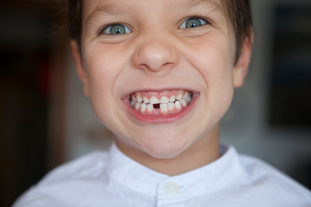 Little 5 years old boy showing his first loose tooth. closeupの写真素材
