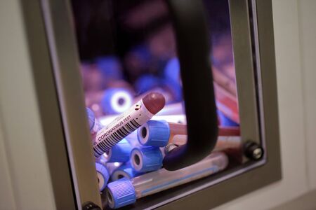 Sample containers for presence of coronavirus (COVID-19) tubesの写真素材