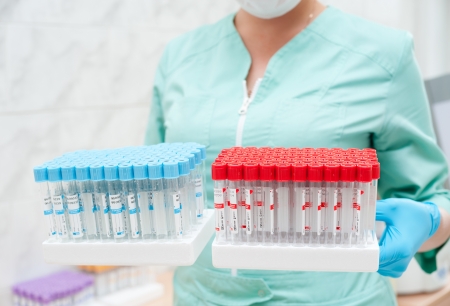 at a clinic laboratory - a nurse holds trays with empty test tubes