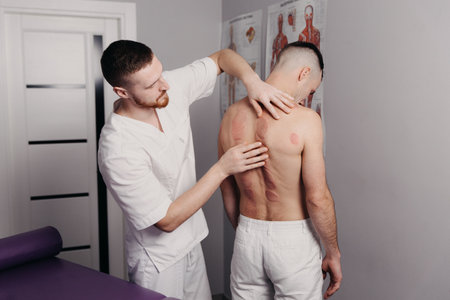 sportsman back after marking of vacuum cupping, sport therapyの写真素材
