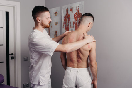 Young man back after marking of vacuum cupping, sport therapyの写真素材