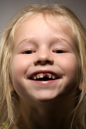funny smiling little girl without one front tooth