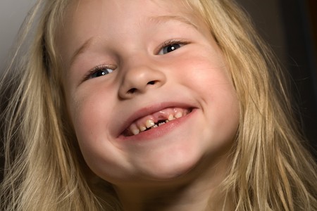 closeup portrait of funny smiling little girl without one front tooth