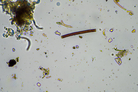 soil microorganisms, with soil fungi hyphae growing in the compost in a farm which is organicの写真素材