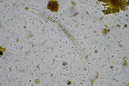 microorganisms and soil biology, with nematodes and fungi under the microscope. in a soil and...