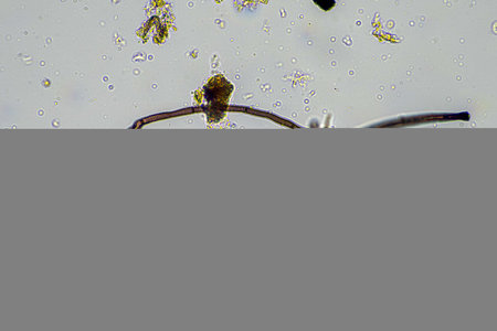 microorganisms and soil biology, with nematodes and fungi under the microscope. in a soil and...