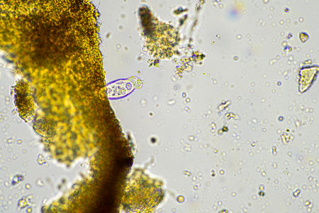 soil microbes organisms in a soil and compost sample, fungus and fungi and under the microscope in...