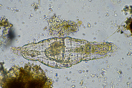 rotifer in a soil sample from a lake