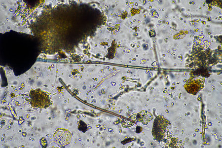 fungal hyphae and soil fungi in a soil sample, showing the living soil form a farm