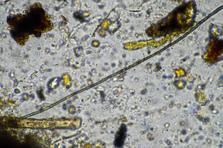fungal hyphae and soil fungi in a soil sample, showing the living soil form a farm