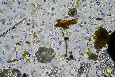 fungal hyphae and soil fungi in a soil sample, showing the living soil form a farm