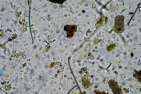 fungal hyphae and soil fungi in a soil sample, showing the living soil form a farm