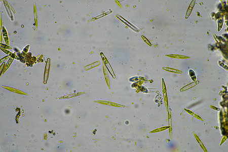 diatom and water microorganisms under the microscope in australiaの写真素材