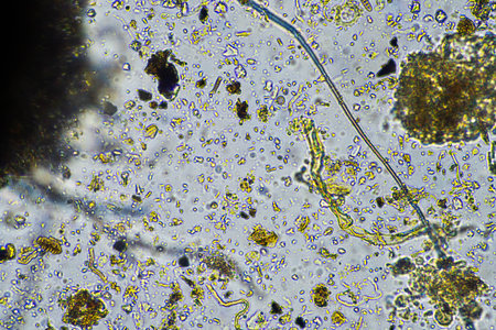 fungal hyphae and soil fungi in a soil sample, showing the living soil from a farm in america