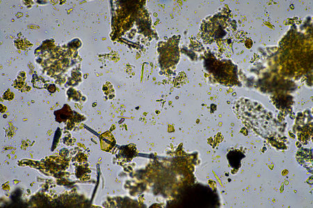 human parasite. gut intestinal infection disease. microorganism infection